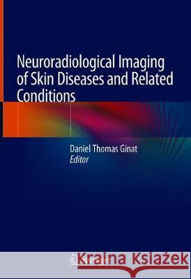 Neuroradiological Imaging of Skin Diseases and Related Conditions Daniel Thomas Ginat 9783319909295 Springer - książka