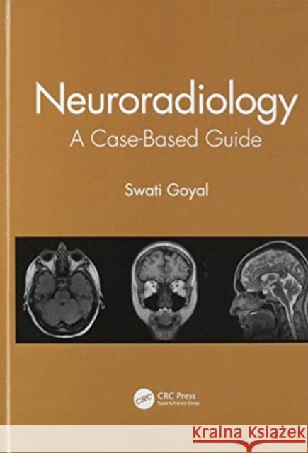 Neuroradiology: A Case-Based Guide Goyal, Swati 9780367548001 CRC Press - książka