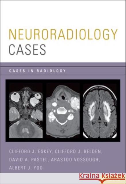 Neuroradiology Cases Clifford J. Eskey Clifford J. Belden David A. Pastel 9780199735983 Oxford University Press, USA - książka