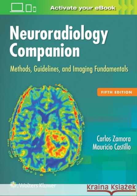 Neuroradiology Companion: Methods, Guidelines, and Imaging Fundamentals Mauricio Castillo Carlos Zamora 9781496322135 LWW - książka