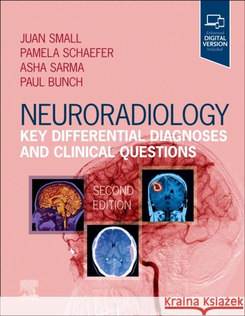 Neuroradiology: Key Differential Diagnoses and Clinical Questions  9780323847612 Elsevier - Health Sciences Division - książka