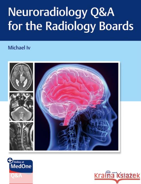 Neuroradiology Q&A for the Radiology Boards Michael Iv 9781684205592 Thieme Medical Publishers Inc - książka