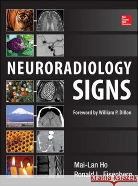 Neuroradiology Signs Mai-Lan Ho Ronald L., M. Eisenberg 9780071804325 McGraw-Hill Professional Publishing - książka