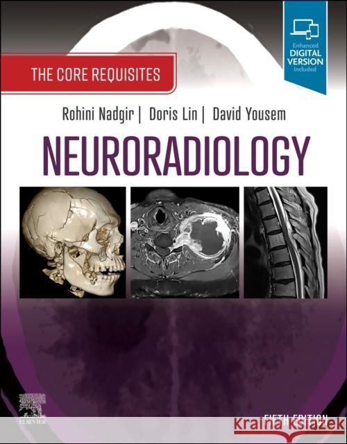 Neuroradiology: The Core Requisites Rohini Nadgir Doris Lin David M. Yousem 9780323759755 Elsevier - Health Sciences Division - książka