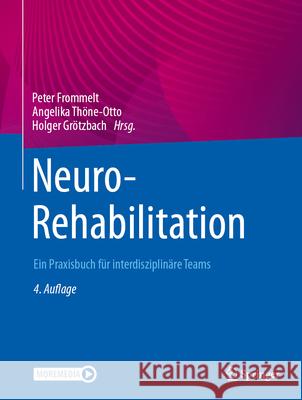 Neurorehabilitation: Ein Praxisbuch F?r Interdisziplin?re Teams Peter Frommelt Angelika Th?ne-Otto Holger Gr?tzbach 9783662669563 Springer - książka