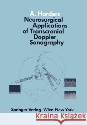 Neurosurgical Applications of Transcranial Doppler Sonography A. Harders 9783211819388 Springer - książka