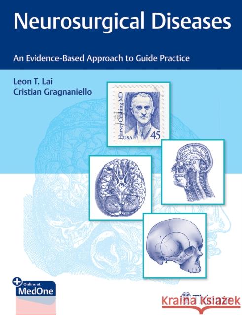 Neurosurgical Diseases: An Evidence-Based Approach to Guide Practice Leon Lai Cristian Gragnaniello 9781684200511 Thieme Medical Publishers - książka
