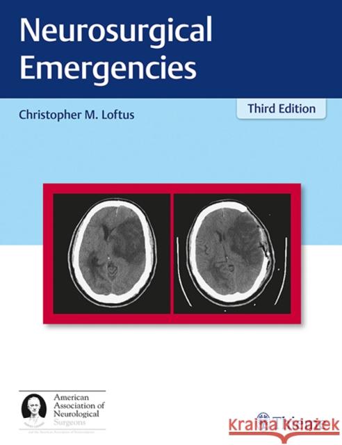 Neurosurgical Emergencies Christopher Loftus 9781626233331 American Association of Neurological Surgeons - książka