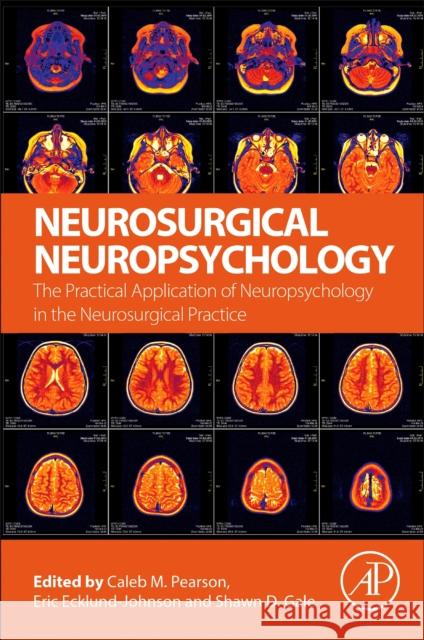 Neurosurgical Neuropsychology: The Practical Application of Neuropsychology in the Neurosurgical Practice Pearson, Caleb 9780128099612 Academic Press - książka