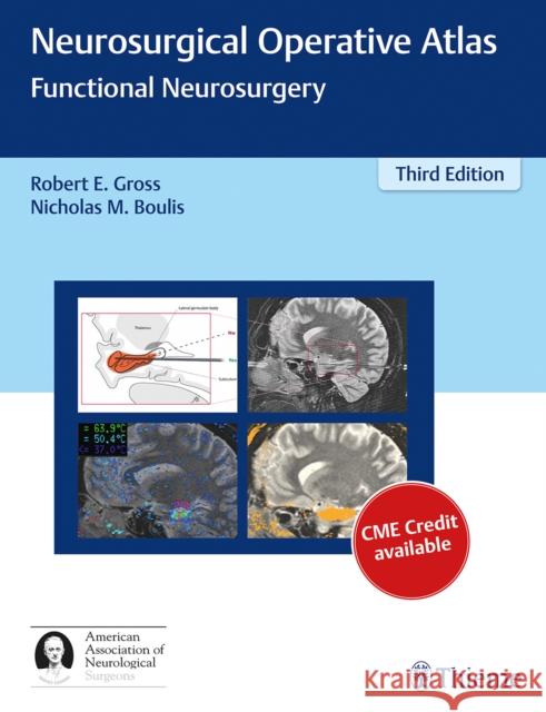 Neurosurgical Operative Atlas: Functional Neurosurgery Gross, Robert E. 9781626231115 American Association of Neurological Surgeons - książka