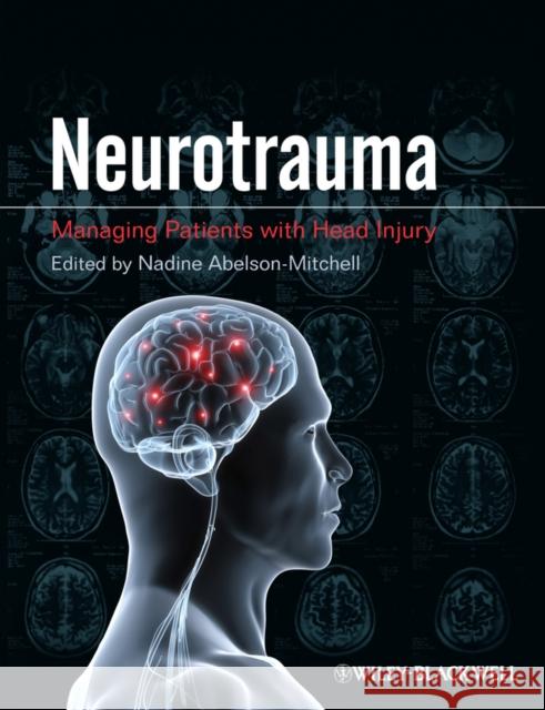 Neurotrauma: Managing Patients with Head Injury Abelson-Mitchell, Nadine 9781405185646 Wiley-Blackwell - książka
