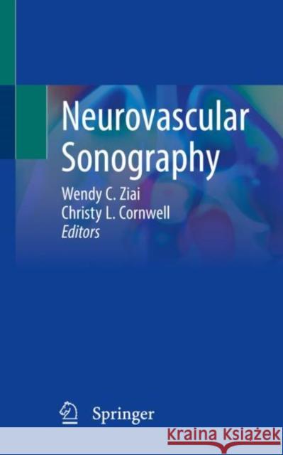 Neurovascular Sonography Ziai, Wendy C. 9783030968922 Springer International Publishing - książka