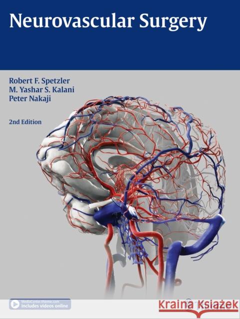 Neurovascular Surgery Robert F. Spetzler M. Yashar S. Kalani Peter Nakaji 9781604067590 Thieme Medical Publishers - książka