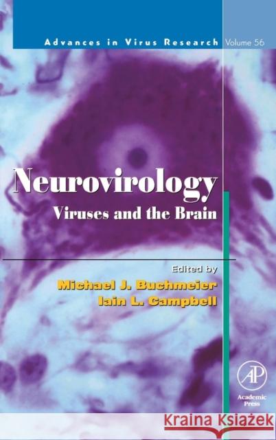 Neurovirology: Viruses and the Brain: Volume 56 Buchmeier, Michael 9780120398560 Academic Press - książka