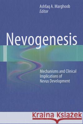 Nevogenesis: Mechanisms and Clinical Implications of Nevus Development Marghoob, Ashfaq A. 9783642283963 Springer - książka