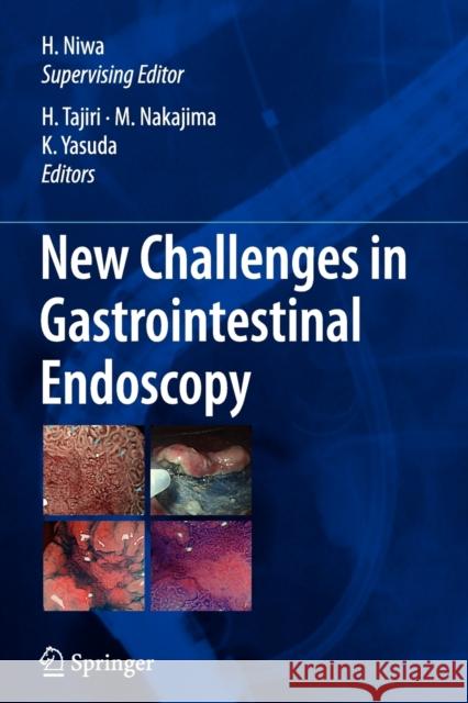 New Challenges in Gastrointestinal Endoscopy Hisao Tajiri Masatsugu Nakajima Kenjiro Yasuda 9784431998525 Springer - książka