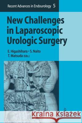 New Challenges in Laparoscopic Urologic Surgery E. Higashihara S. Naito M. Tadashi 9784431680154 Springer - książka