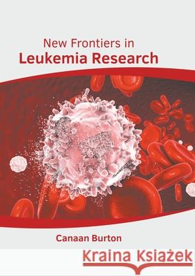 New Frontiers in Leukemia Research Canaan Burton 9781639893768 States Academic Press - książka
