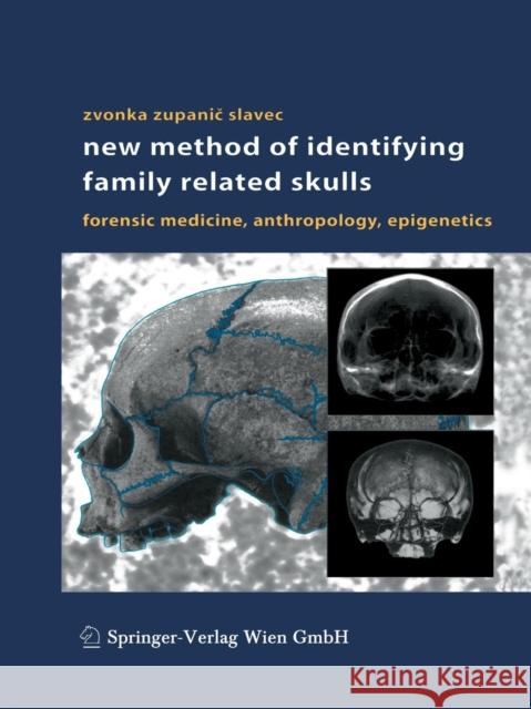 New Method of Identifying Family Related Skulls: Forensic Medicine, Anthropology, Epigenetics Zupanic Slavec, Zvonka 9783709172070 Springer - książka