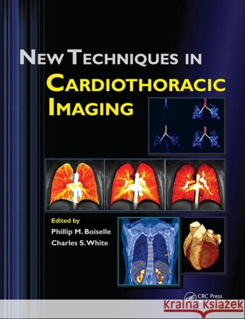 New Techniques in Cardiothoracic Imaging Phillip M. Boiselle Charles S. White 9780367452964 CRC Press - książka