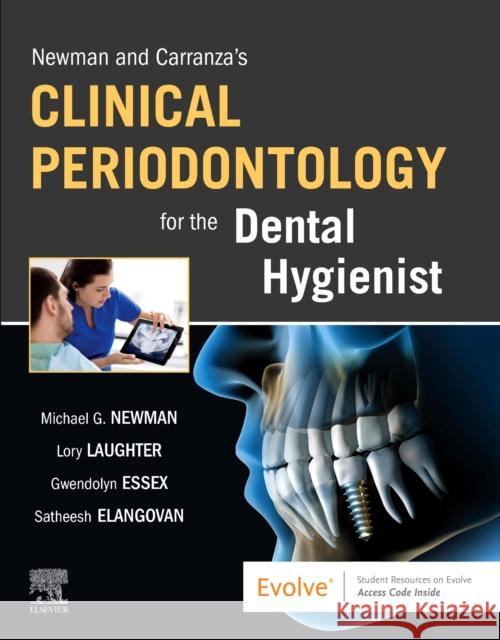 Newman and Carranza's Clinical Periodontology for the Dental Hygienist Newman, Michael G. 9780323708418 Elsevier - książka