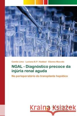 NGAL - Diagnóstico precoce da injúria renal aguda Lima, Camila 9786202038539 Novas Edicioes Academicas - książka