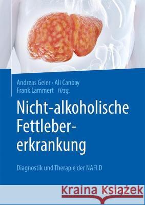 Nicht-Alkoholische Fettlebererkrankung: Diagnostik Und Therapie Der Nafld Andreas Geier Ali Canbay Frank Lammert 9783662624838 Springer - książka