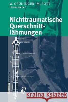 Nichttraumatische Querschnittlähmungen Werner G Michael Pott 9783642937262 Steinkopff-Verlag Darmstadt - książka