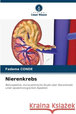 Nierenkrebs CONDE, Fadama 9786202002950 Verlag Unser Wissen - książka