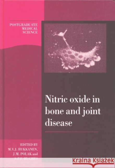 Nitric Oxide in Bone and Joint Disease M. V. J. Hukkanen S. P. Hughes J. M. Polak 9780521592208 Cambridge University Press - książka