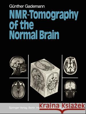 Nmr-Tomography of the Normal Brain Gademann, Günther 9783642696220 Springer - książka