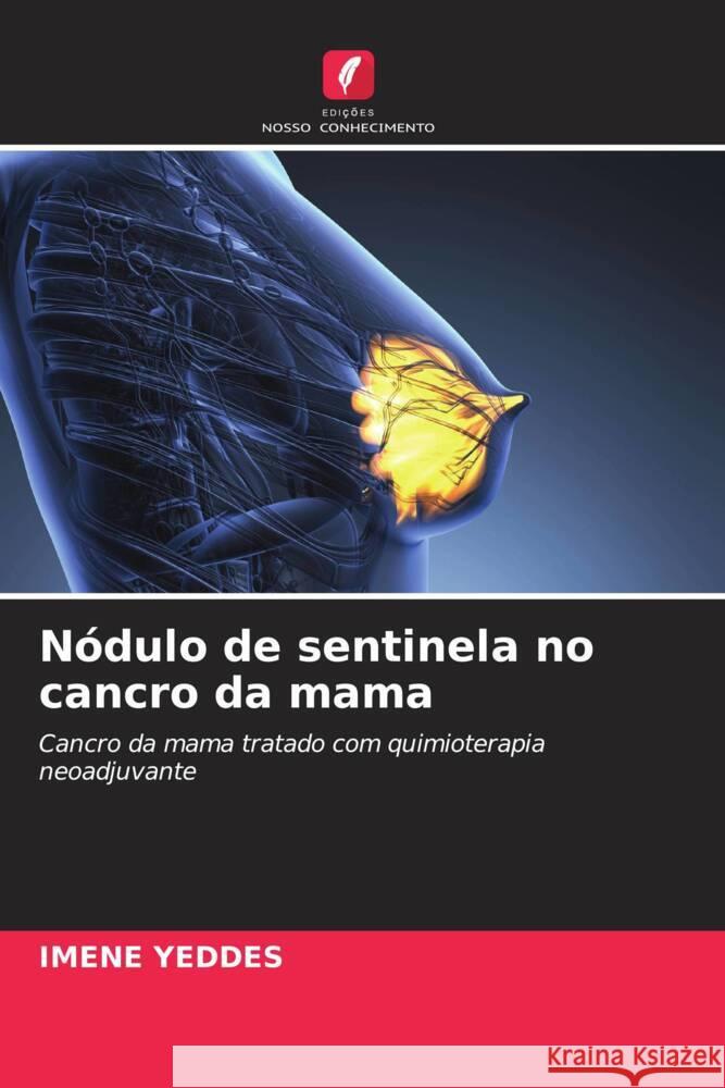 Nódulo de sentinela no cancro da mama Yeddes, Imene 9786205233870 Edições Nosso Conhecimento - książka