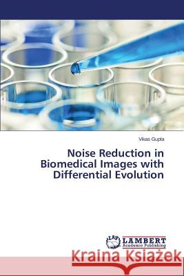 Noise Reduction in Biomedical Images with Differential Evolution Gupta Vikas 9783659533877 LAP Lambert Academic Publishing - książka