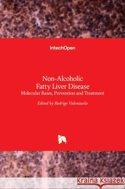 Non-Alcoholic Fatty Liver Disease: Molecular Bases, Prevention and Treatment Rodrigo Valenzuela 9789535139232 Intechopen - książka