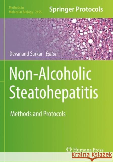 Non-Alcoholic Steatohepatitis: Methods and Protocols Devanand Sarkar 9781071621301 Humana - książka