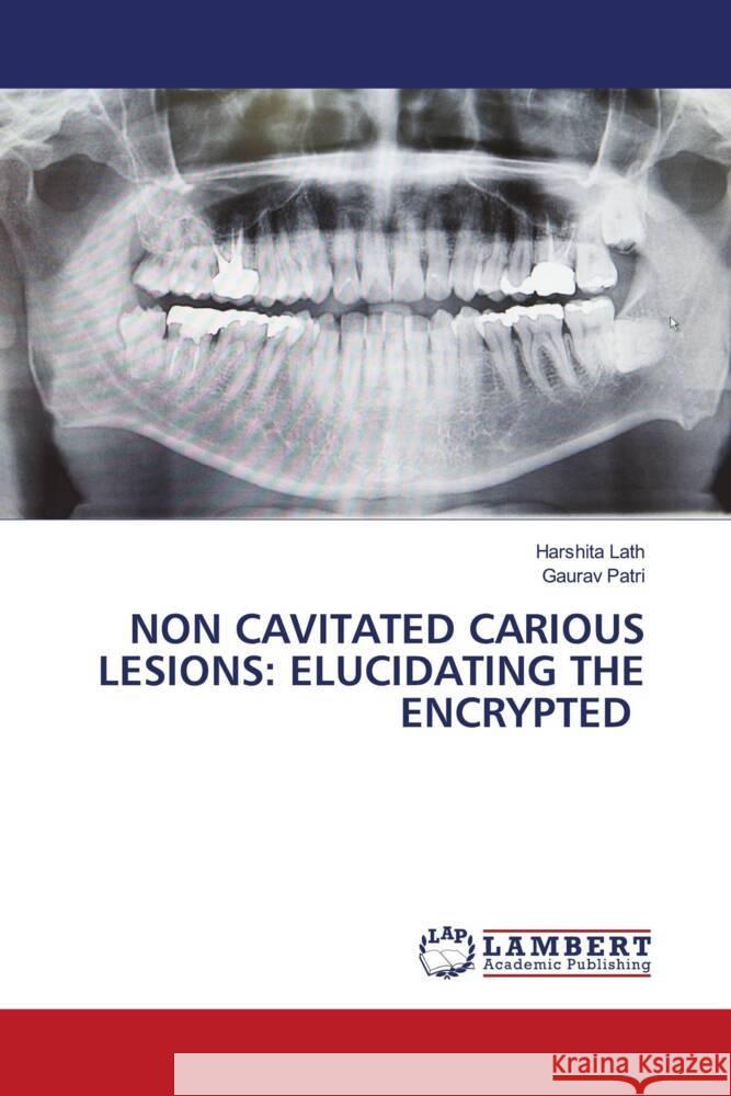 NON CAVITATED CARIOUS LESIONS: ELUCIDATING THE ENCRYPTED Lath, Harshita, Patri, Gaurav 9786204209647 LAP Lambert Academic Publishing - książka