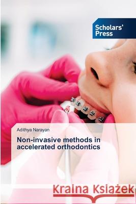 Non-invasive methods in accelerated orthodontics Narayan, Adithya 9786209459276 Scholars' Press - książka