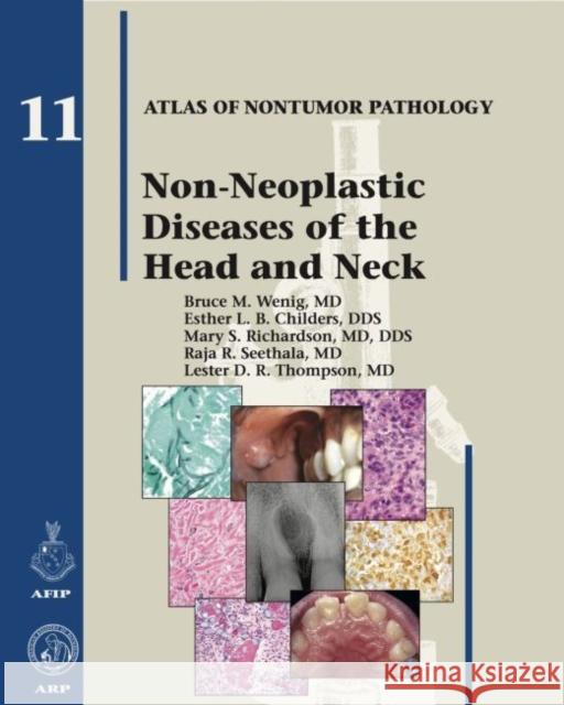 Non-Neoplastic Diseases of the Head and Neck  Wenig, Bruce M.|||Childers, Esther L. B.|||Richardson, Mary S. 9781933477374 AFIP Atlas of Nontumor Pathology, Series 1, N - książka
