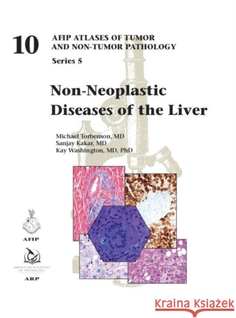 Non-Neoplastic Diseases of the Liver Michael Torbenson, MD Sanjay Kakar Kay Washington 9781933477183 American Registry of Pathology - książka