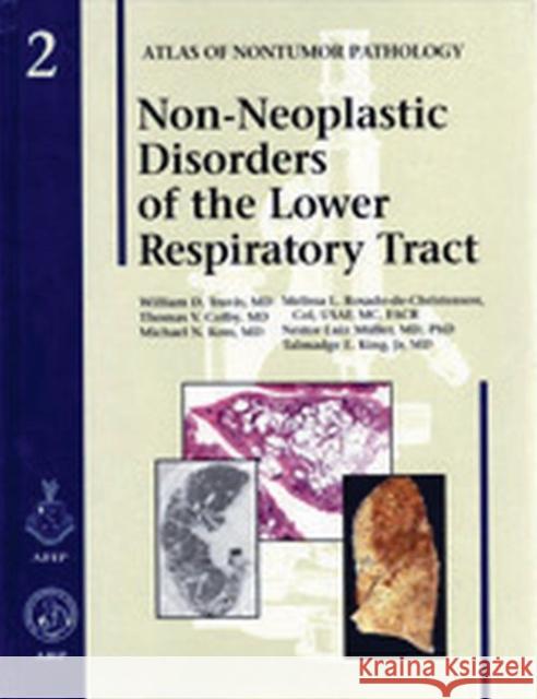 Non-Neoplastic Disorders of the Lower Respiratory Tract D. William Travis 9781881041795 American Registry of Pathology - książka
