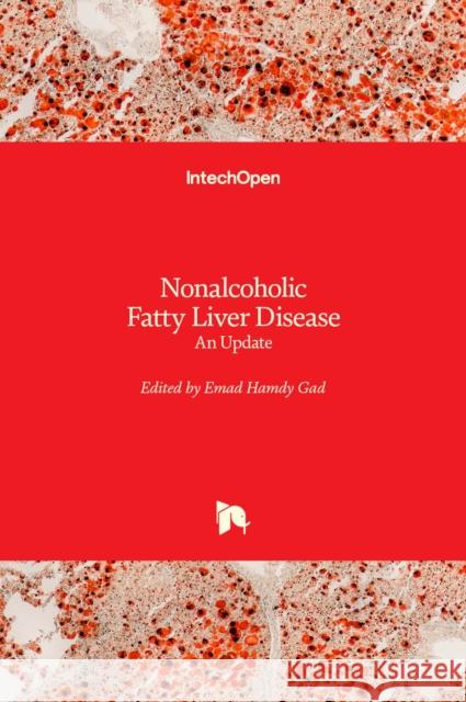 Nonalcoholic Fatty Liver Disease: An Update Emad Hamdy Gad 9781839628696 Intechopen - książka