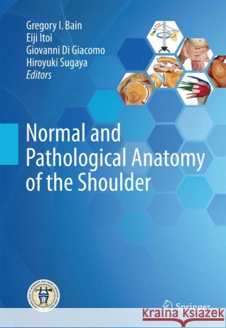 Normal and Pathological Anatomy of the Shoulder Gregory I. Bain Eiji Itoi Giovanni D 9783662525609 Springer - książka