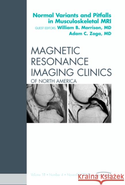Normal Variants and Pitfalls in Musculoskeletal MRI, An Issue of Magnetic Resonance Imaging Clinics William B. Morrison Adam C. Zoga 9781455703036 W.B. Saunders Company - książka