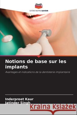 Notions de base sur les implants Inderpreet Kaur Jatinder Singh 9786202209328 Editions Notre Savoir - książka