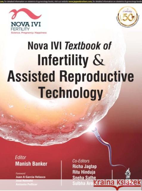 Nova IVI Textbook of Infertility & Assisted Reproductive Technology Manish Banker 9789388958844 Jp Medical Ltd - książka