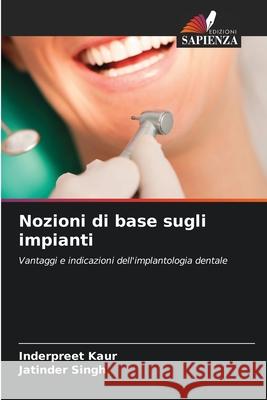 Nozioni di base sugli impianti Inderpreet Kaur Jatinder Singh 9786202209366 Edizioni Sapienza - książka