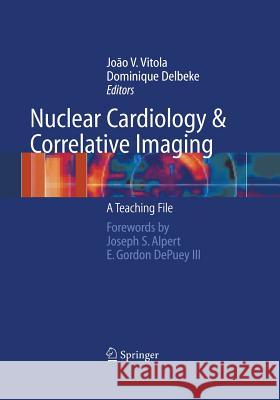 Nuclear Cardiology and Correlative Imaging: A Teaching File Vitola, Joao V. 9781461273929 Springer - książka