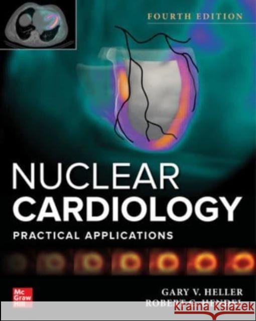 Nuclear Cardiology: Practical Applications, Fourth Edition Gary V. Heller Robert C. Hendel 9781264257201 McGraw-Hill Education / Medical - książka