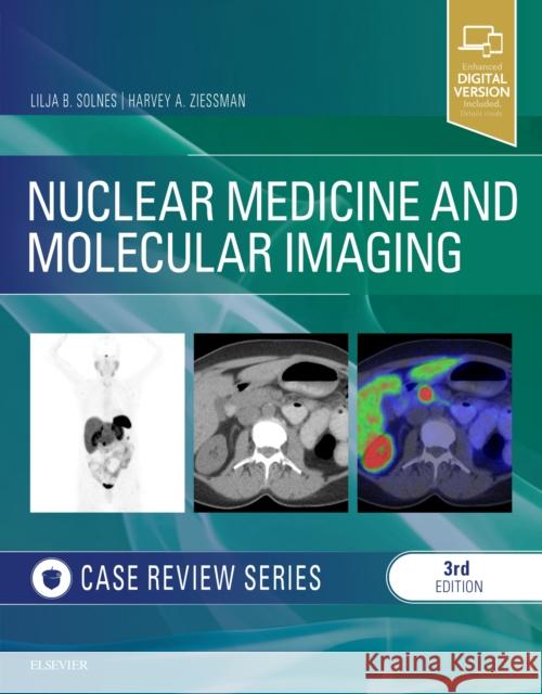 Nuclear Medicine and Molecular Imaging: Case Review Series Lilja B. Solnes Harvey A. Ziessman 9780323529945 Elsevier - książka