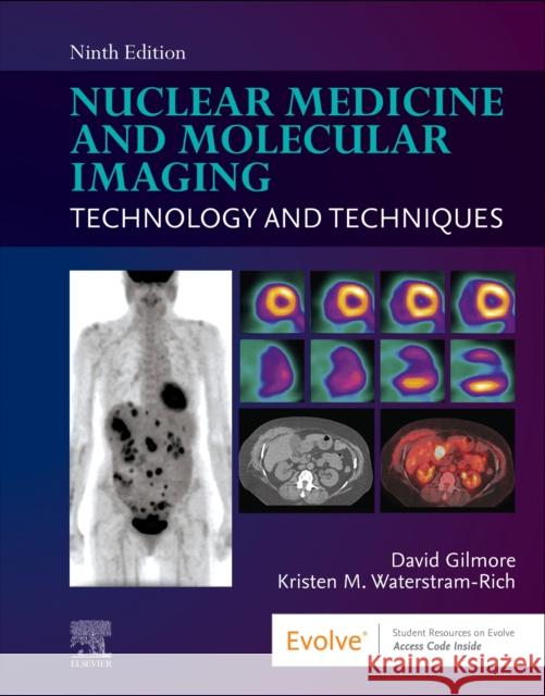 Nuclear Medicine and Molecular Imaging: Technology and Techniques Kristen M., MS, CNMT, NCT, FSNMTS (Kristen M. Waterstram-Rich, MS, CNMT, FSNMMI-TS, Professor, Interim Associate Dean, C 9780323775502 Elsevier - Health Sciences Division - książka